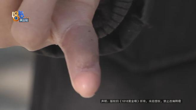 都断了……街头常见看见立即远离！m6米乐后怕！5岁男童瞬间晕厥筋(图2)