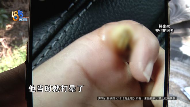 都断了……街头常见看见立即远离！m6米乐后怕！5岁男童瞬间晕厥筋(图8)